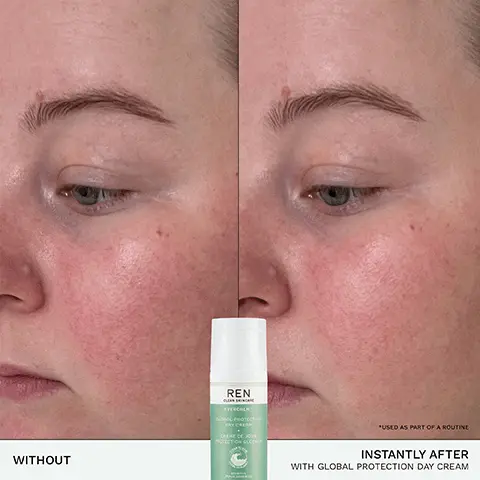 For sensitive skin, suitable for eczema- prone skin