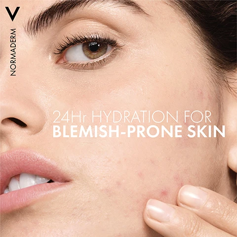 Image 1 - A close-up of a woman with blemish-prone skin showing her face, with visible text reading 24Hr HYDRATION FOR BLEMISH-PRONE SKIN and the brand name NORMADERM in the top left corner.
Image 2 - A hand is shown with a clear gel-like substance being applied to it, accompanied by the text ULTRA LIGHTWEIGHT FAST ABSORPTION at the top left and NORMADERM in the top left corner.
Image 3 - A green bottle of Vichy Normaderm skincare product is shown, with the text displaying NON-COMEDOGENIC NON-OILY NON-STICKY next to it.
Image 4 - A person in a white coat holds a green bottle of Vichy Normaderm Double-Correction Moisturizing Care, with the text Recommended by Dermatologists prominently displayed.
Image 5 - Image shows a skincare routine featuring three products from Vichys Normaderm line, including a cleansing gel on the left labeled STEP 1 CLEANSE, a correcting serum in the center labeled STEP 2 CORRECT, and a hydrating cream on the right labeled STEP 3 HYDRATE, all against a simple background with the title NORMADERM BLEMISH-PRONE SKIN ROUTINE.
Image 6 - Image shows two green skincare bottles side by side with arrows indicating a change, labeled FROM above the left bottle and TO above the right bottle, and the text NEW PACKAGING IMPROVED FORMULA prominently displayed.