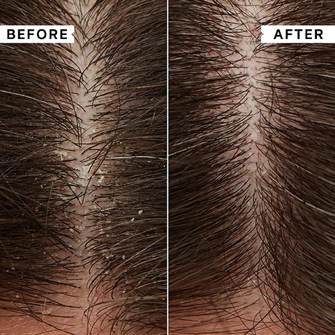 Image 1, before and after. image 2, key benefits. super lightweight formula delivers concentrated hydration. doesn't weigh hair down. suitable for oily or limp hair. image 3, 90% reported hair felt moisturised after use. independent user trial results. image 4, key ingredients. pataua oil - a powerful moisturising ingredients. pro vitamin B5 - improves combability and shine. betaine - softening and hydrating. image 5, after using this conditioner my hair felt amazing. clean, soft and silky and no dandruff - customer review. image 6, before and after.