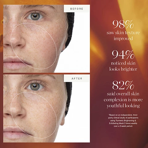 Image 1 - Image shows a side-by-side comparison of a persons face labeled Before at the top and After at the bottom, with statistics about skin improvement; statistics include 98% saw skin texture improved, 94% noticed skin looks brighter, and 82% said overall skin complexion is more youthful looking.
Image 2 - Image shows three skincare products from KORA Organics: a gold tube labeled Turmeric Brightening & Exfoliating Mask, a new packaging version of the same mask in a gold box, and a white box with an orange image of turmeric powder, all against a light background with the text New Look, Same Formula above.