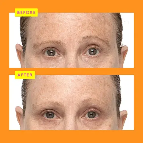 Image 1, BEFORE AFTER Image 2, DRUNK ELEPHANT so now you're a mixologist? meet C-Firma Fresh A super-potent vitamin C day serum that firms, brightens, and improves signs of photoaging, leaving skin impossibly radiant. Mix it once and you're good to glow. HOW TO Shake Things Up STEP fresh firm bright skin STEP STEP 2 M POUR SHAKE SNAP Image 3, 15% vitamin C firms and brightens while minimising signs of photoaging pumpkin ferment and pomegranate extract helps to dissolves dead surface skin cells minimising the appearance of pores chronocyclin mimics the antioxidant benefits of vitamin D for more youthful looking skin Image 4, clinically proven to... improve skin tone and texture, minimize visible hyperpigmentation and dark spots, and boost skin's radiance 84% agreed skin felt smoother* 74% agreed their complexion looked more even and radiant "In a consumer-perception study with 31 people after 8 days of use C-Firma" Fresh Day Serum Sérum de jour + Artic Acid Meric Acid གོང Image 5, FACE-OFF SERUM EDITION C-FirmaTM Fresh Day Serum KEY INGREDIENTS MORNING 15% L-Ascorbic Acid + Ferulic Acid Perfect for anyone looking to brighten uneven tone and firm skin-and wants the freshest vitamin C around ProtiniTM Powerpeptide Resurf Serum ANYTIME (DAY OR NIGHT) KEY INGREDIENTS 10% Lactic Acid + 11 Signal Peptides Perfect for anyone looking for gentle AHA exfoliation with a shot of peptides to achieve plump, smooth, radiant skin T.L.C. FramboosTM Glycolic Night Serum NIGHT KEY INGREDIENTS 10% AHA +1% BHA Perfect for anyone looking for a powerful nightly exfoliant to resurface and improve the look of skin's tone and texture, fine lines, and pores Image 6, brighter, bouncier, better together! Use both to make the skin more radiant, even-toned, and glowing. Bouncy Brightficial" Masque illuminateur Image 7, absolute power smoothie for brighter, firmer, more moisturized skin 1 PUMP C-Firma Fresh C-F Dy 1 PUMP Protini 1 PUMP B-Hydra Mix it all together and apply.