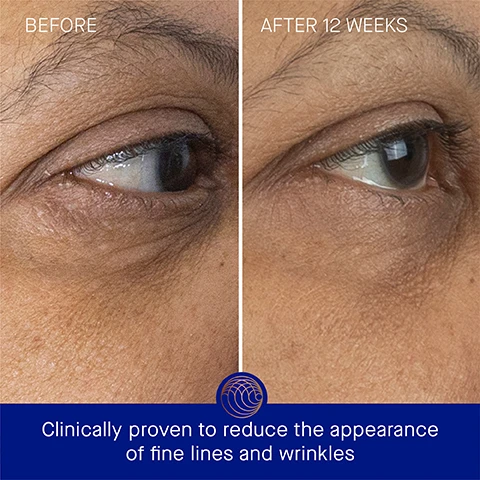Image 3 - Image showing a side-by-side comparison of an eye area labeled Before on the left and After 12 Weeks on the right, with visible improvement in skin texture and reduced fine lines; text below reads Clinically proven to reduce the appearance of fine lines and wrinkles.
Image 4 - Image showing a side-by-side comparison of the eye area before and after 12 weeks of treatment, with text indicating the results; visible text includes BEFORE, AFTER 12 WEEKS, and Clinically proven to reduce the appearance of dark circles and increase luminosity.
Image 5 - A golden cylindrical eye cream bottle is positioned on a light background with softly angled shadows, featuring text that states Clinically Proven Results, The appearance of fine lines are reduced by 57%, Skin hydration is improved by over 3x, Skin luminosity is improved by 2.9x, and a note about a clinical trial.
Image 6 - An image of a product bottle for eye cream against a blue background, with text stating that 99% agree tired eyes look refreshed, luminous, and well-rested; 99% agree the eye area appears more youthful, tighter, and less crepey; and 95% agree crows feet look noticeably reduced.
Image 7 - An orange bottle of eye cream with a white cap is placed on a white surface, surrounded by text describing its ingredients: TFC8 - A proprietary technology that creates the optimal environment for skin cellular renewal, Arjun tree extract - Helps firm and combat signs of aging, Duo of seaweed extracts - Minimizes the appearance of puffiness and dark circles, and Vitamin C - Supports collagen production and brightens complexion.
Image 8 - Image shows three instructional steps for applying a skincare product: Step 1 displays a hand dispensing one pump of product onto fingertips; Step 2 shows a person gently tapping product around their eyes; Step 3 captures a person smoothing the product into their skin, with visible text detailing each step.
Image 9 - Image shows two eye cream products on a blue background; on the left is The Eye Cream in a pump bottle with text describing it as lightweight, hydrating, and ideal for combination to oily skin, while on the right is The Rich Eye Cream in a jar described as luxuriously rich, lifting, and ideal for combination to very dry or aging skin.
Image 10 - A list of skincare products titled The Routine includes five steps: 1. Cleanse with The Cream Cleansing Gel, 2. Tone & Exfoliate with The Essence, 3. Correct & Illuminate with The Serum, 4. Balance & Hydrate with The Light Cream, and 5. Revitalize & Refresh with The Eye Cream.
Image 11 - A brown and gold tube of eye cream labeled THE EYE CREAM WITH TFC8 stands next to a blue and gold bottle, both sitting on a reflective surface, with the text 15 ml Refill and 15 ml visible.