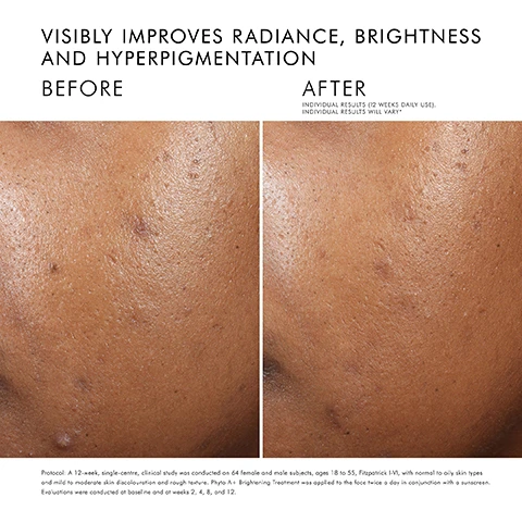 Image 1 - Image comparing skin before and after treatment, showing improvement in radiance and reduction of hyperpigmentation, with visible text that reads VISIBLY IMPROVES RADIANCE, BRIGHTNESS AND HYPERPIGMENTATION BEFORE AFTER INDIVIDUAL RESULTS (12 WEEKS DAILY USE). INDIVIDUAL RESULTS WILL VARY.
Image 2 - Image of a SkinCeuticals skincare product with a pump bottle labeled PHYTO A+ BRIGHTENING TREATMENT alongside a green cream swipe, featuring text that states Corrects: Out-of-balance skin to enhance radiance, texture and clarity, Improves: The appearance of discolouration, including post-inflammatory hyperpigmentation, Targets: Dullness, uneven skin tone and excess oil.
Image 3 - A close-up of a persons face with a light green gel being applied to their cheek, accompanied by text that reads Soothes + helps to correct out-of-balance skin.
Image 4 - Image shows a skincare regimen with four steps labeled as cleanse, prevent, correct, and protect, featuring products: Gentle Cleanser, Silymarin CF, Phyto A+ Brightening Treatment, and Advanced Brightening UV Defense Sunscreen SPF 50.
Image 5 - An instructional graphic detailing a nighttime skincare regimen with four steps: a gentle cleanser, resveratrol B E, phyto corrective, and phyto A+ brightening treatment, with each step clearly labeled.