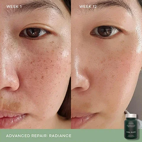 week 1 vs week 12, advanced repair: radiance.