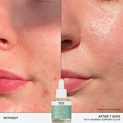 Image 1, REN WITHOUT 30102c US *USED AS PART OF A ROUTINE AFTER 7 DAYS WITH BARRIER SUPPORT ELIXIR Image 2, REN CLEAN SKINCARE EVERCALMTH BARRIER SUPPORT ELIXIR ELIXIR FORTIFIANT BARRIÈRE CUTANEE 30 mle/1.02 fl. oz. US. PEAUX SENSIBLES SENSITIVE 96% SHOWED A STRONGER SKIN BARRIER* *CLINICAL STUDY AFTER 14 DAYS ON SO VOLUNTEERS Image 3, ✓ ✓ CALMS NOURISHES SOFTENS STRENGTHENS MICROBIOME-FRIENDLY FAMILY SAFE Image 4, BIOACTIVES → CAMELLIA JAPONICA SEED OIL helps replenish the skin barrier → INCA INCHI OIL helps preserve lipid balance MEADOWFOAM SEED OIL helps strengthen the skin barrier Image 5, RECYCLABLE GLASS BOTTLE PCR PLASTIC DROPPER REN EVERGALM DARRIER GUPPORT CLIXIR ELIXIR FORTIFIANT CARRIERE CUTANCE 30 mle/102 fl. oz. US Image 6, STEP 01 CLEANSE STEP 02 TARGET STEP 03 STRENGTHEN STEP 04 PROTECT REN GENTLE CLEANING WILK VISME REN REN GENTLE CLEANSING REDNESS RELIEF MILK SERUM BARRIER SUPPORT ELIXIR REN PROTECTION CREA OPECTION CO GLOBAL PROTECTION DAY CREAM