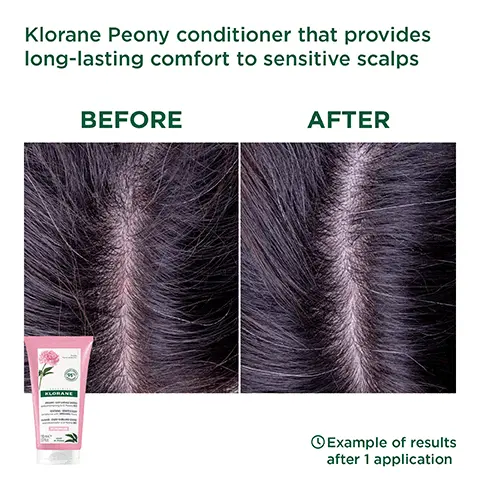 Klorane Peony conditioner that provides long-lasting comfort to sensitive scalps. Before, after. Example of results after 1 application. With or no rinse. 95% of natural origin ingredients. Biodegradable formula. Without animal origin ingredients. OECD 3O1B. Soothes feelings of discomfort and irritation of the scalp immediately and for 48 hours. 95% of natural origin ingredients, moisturises and softens hair. Consumer user test, perceived effects among 137 subjects who used the conditioner for 21 days. 1, wash, 2, detangle.