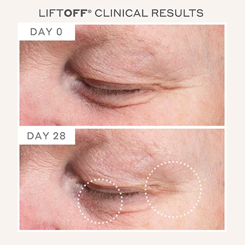 Image 1 - Image showing clinical results of a skincare product with two close-up photos of an eye area labeled DAY 0 on the top and DAY 28 on the bottom, with visible changes in skin texture and appearance, including dotted circles highlighting areas of improvement.
Image 2 - A side-by-side comparison of a mans forehead showing skin before treatment on Day 0 and after 28 days, with noticeable reduction in wrinkles; visible text includes LIFTOFF® CLINICAL RESULTS, DAY 0, and DAY 28.
Image 3 - Image shows a side-by-side comparison of a persons face indicating skin appearance changes from day 0 to day 28, with highlighted areas showing reduced fine lines and wrinkles; visible text includes LIFTOFF® CLINICAL RESULTS, DAY 0, and DAY 28.
Image 4 - A person holds a white skincare device with two metal spheres at the top, labeled MAGNITONE LONDON, accompanied by several text points on the right, including Clinically proven to improve skin firmness, A workout for your face, Just 5 minutes/day to see results, Microcurrent technology, 4 strength settings, Hypoallergenic skin contacting points, 5 second timer, and USB rechargeable.
Image 5 - A smiling woman with freckles uses the Magnitone LiftOff microcurrent facial toning device on her cheek, with text that reads LIFTOFF Microcurrent Facial Toning Device In a clinical study of 20 participants, regular use of the Magnitone LiftOff with the Super Conductive Gel was shown to Significantly firm skin by up to 47% With regular use over 4 weeks. Individual results will vary.
Image 6 - A young man with short hair is smiling while using a gray facial toning device on his cheek, and there are award badges in the corner that read Beauty Awards Platinum Winner 2024, Woman&Home Clever Skincare Winner 2021 Best Facial Toning Tool, and Menopause Friendly Clinically Proven.