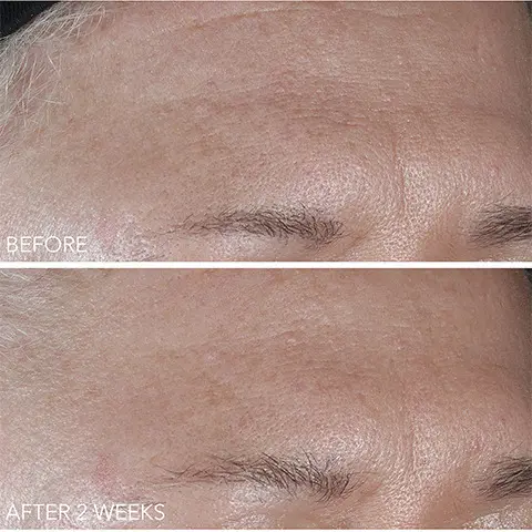 Image 1 to 3, Before and After results shots