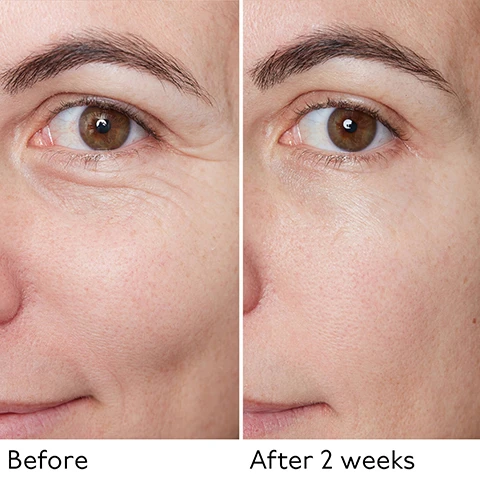 Image 1 - A before and after comparison image of a persons eye and cheek, showing a reduction in wrinkles, with the text Before and After 2 weeks. Image 2 - An image of a By Terry Hyaluronic Global Serum bottle with a purple dropper and a liquid droplet falling, set against a dark purple background with abstract molecular shapes, featuring prominent text that states Record-Breaking 10% Hyaluronic Acid and 8x Hyaluronic Acid Types Exclusive Technology, while the bottle label reads By Terry Hyaluronic Global Serum and 8 Hyaluronic Acids Exclusive Technology. Image 3 - An infographic illustrates how 8x Hyaluronic Acid Types, part of Exclusive Technology, penetrate Epidermis Layers, detailing x2 High HA Molecular Weight for Immediate Hydration, x2 Medium HA Molecular Weight which Fills Plumps and Smooths, and x4 Low HA Molecular Weight for Long-Lasting Hydration. Image 4 - The image shows multiple clear glass bottles of By Terry Hyaluronic Global Serum, which features 8 Hyaluronic Acids Advanced Technology, with purple caps and droppers, accompanied by text detailing its Key Ingredients: HYDRATES & PLUMPS 10% Hyaluronic Acid, NOURISHES & PROTECTS 5% Phytosqualane, BRIGHTENS & EVENS TONE 5% Niacinamide, FIRMES & SMOOTHES 5% Peptide Complex, and two badges stating VEGAN FORMULA and CLEAN FORMULA. Image 5 - A By Terry Hyaluronic Global Serum bottle with a dropper is shown against a purple background, accompanied by text detailing its benefits: RENEWS & REPLENISHES from within, EVENS tone & texture, IMPROVES firmness & elasticity, BOOSTS collagen production, SMOOTHS fine lines & wrinkles, and the product name BY TERRY HYALURONIC GLOBAL SERUM 8 HYALURONIC ACIDS EXCLUSIVE TECHNOLOGY. Image 6 - A woman with radiant skin holds a small bottle of serum, with overlaid text displaying product benefits: 124% Increase in Skin Moisture, 95% Experienced Smoother, More Even Texture*, 90% Noticed Plumper, More Protected Skin*. The bottle is labeled BY TERRY HYALURONIC GLOBAL SERUM HYALURONIC ACIDS SKINCARE TECHNOLOGY, and disclaimers read *Clinical evaluation 1 hour post-application on 11 participants. **Satisfaction test on 21 volunteers. Image 7 - Four By Terry Hyaluronic skincare products, specifically an eye serum tube, a global serum dropper bottle, a face cream jar, and a glow setting mist spray bottle, are arranged next to text displaying Hyaluronic Skincare Ritual, STEP 1: Hyaluronic Global Serum, STEP 2: Hyaluronic Global Face Cream, STEP 3: Hyaluronic Global Eye Serum, STEP 4: Hyaluronic Glow Setting Mist, with product labels showing By Terry and 8 Hyaluronic Acid Types.