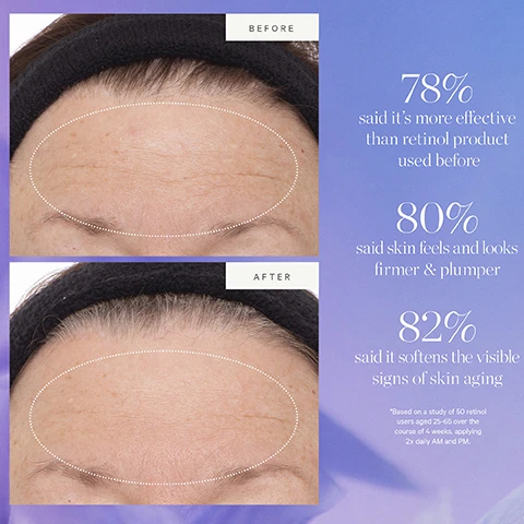 Image 1 - Before and after images show a forehead with visible wrinkles and then fewer wrinkles, with text stating BEFORE, AFTER, 78% said its more effective than retinol product used before, 80% said skin feels and looks firmer & plumper, 82% said it softens the visible signs of skin aging, Based on a study of 50 retinol users aged 25-65 over the course of 4 weeks, applying 2x daily AM and PM. Image 2 - Illustration showing a purple serum bottle and a white and glass dropper with text boxes detailing recycling steps reading KEEP YOUR GLOW WITHOUT THE WASTE HOW TO RECYCLE Plant Stem Cell Retinol Alternative Serum Remove plastic wiper guard from 30ml size and recycle separately Rinse out any remaining or excess product Recycle the glass bottle* Remove the dropper and discard Recycle the glass pipette separately *CONFIRM YOUR LOCAL RECYCLING PROGRAM Image 3 - A side-by-side comparison of the old and new packaging for KORA Organics Plant Stem Cell Retinol Alternative Serum bottles and boxes, with the text New Look Same Formula NEW Please note Packaging may vary For a limited time you may receive either of these packages.