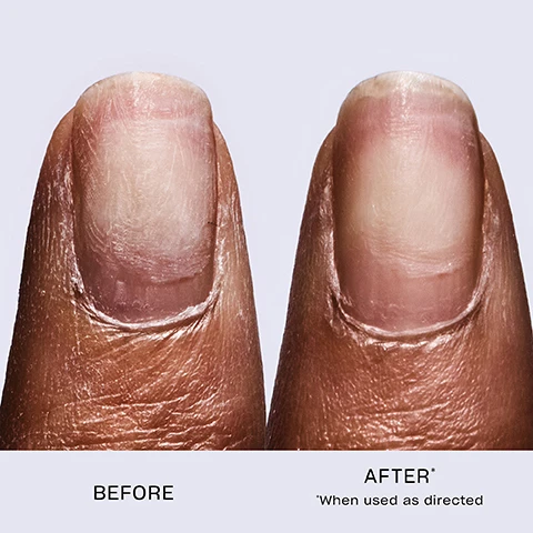 Image 1 - Image shows two close-up views of a fingernail; the left side labeled BEFORE shows a damaged nail, and the right side labeled AFTER* displays a healthier nail appearance with a note stating *When used as directed.
Image 2 - A bottle of O.P.I Repair Mode nail serum stands on a bright green surface, with a white applicator sticking out, alongside droplets of water, featuring visible text that reads 99% Nail Keratin Repair*.
Image 3 - A close-up of a hand with dark skin applying a clear product to a bare, manicured nail, featuring text that reads First Ever Patented Ulti-Plex Technology™ and Vegan Formula*.