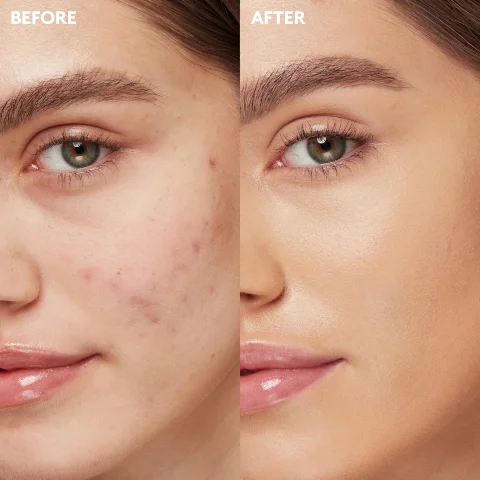 before and after model shot image