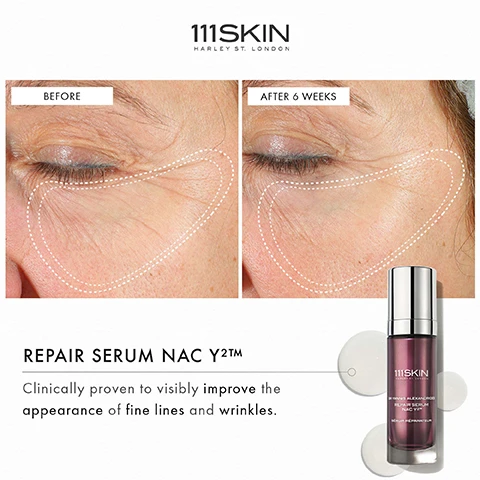 Image 1 - The image shows a side-by-side comparison of a persons eye area labeled Before and After 6 weeks with visible improvements in skin texture, alongside a product bottle of 111SKIN Repair Serum NAC Y2™ and the text Clinically proven to visibly improve the appearance of fine lines and wrinkles.
Image 2 - Image shows a side-by-side comparison of an eye area with a marked outline; the left image labeled Before shows prominent fine lines, while the right image labeled After 6 Weeks displays a smoother appearance, with a product bottle for EYE LIFT GEL NAC Y²™ featuring the text Clinically proven to visibly improve the appearance of fine lines around the eyes.