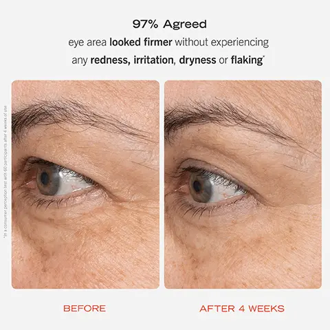 97% Agreed eye area looked firmer without experiencing any redness, irritation, dryness or flaking. BEFORE. AFTER 4 WEEKS. Visibly smooths fine lines + wrinkles, while hydrating Peptides strengthen moisture barrier. Encapsulated Retinol Provides a slow-release delivery to smooth the delicate eye area with less redness + irritation. 0.3% Retinol Complex Serum. Face Cleanser. Retionl Eye Cream. Firming Cream. Firming Face Rotuine with a sensitive side. Eye spy an upgrade. New look + improved formula.
