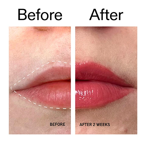 Image 1 - A close-up before and after image comparison of lips, with the before image showing naturally thinner lips outlined by a dashed line, and the after image showing visibly plumper, rosier, and glossier lips, with text Before, After, BEFORE, and AFTER 2 WEEKS. Image 2 - A close-up image shows a person with dark skin applying a glossy, dark red lip product from a white applicator to their lower lip, alongside text that reads Plumps lips by up to 40% after 4 weeks* and a smaller disclaimer *4-week independent clinical study of 20 people under dermatological control, with 0.33 US FL visible on the applicator. Image 3 - A person with dark skin applies a glossy, reddish lip treatment to their plump lips, revealing white teeth, with text reading Plumps lips by up to 40% after 4 weeks **, 95% agree lips felt instantly nourished and hydrated after first use*, *4-week independent clinical study of 20 people under dermatological control. **4-week independent consumer trial of 20 people under dermatological control. Image 4 - The image displays a shimmering red textured background above text that reads Why we love it, followed by bullet points: Plumps lips, without stinging or irritation; Silky, smooth and never sticky; Pocket-sized: swipe, plump and go. Image 5 - A white background features a glossy, dark red liquid smear on the right, with text that reads: Why it works. 6% Tripeptide Complex VISIBLY INCREASES LIP VOLUME FOR PLUMPER-LOOKING, MORE DEFINED LIPS. 2% Ultra Filling Spheres DELIVERS HA WITHIN THE LIP TO PLUMP, RETAIN MOISTURE AND FILL FINE LINES. Image 6 - An image displays product usage instructions and a hand holding a tube of lip balm. The instructions read: How to use, USE AM + PM AS NEEDED. APPLY TO CLEAN DRY LIPS. USE AT LEAST X3 DAILY FOR 4 WEEKS FOR OPTIMAL RESULTS. TOP UP AS NEEDED - CONSISTENCY IS KEY. The white lip balm tube held by the hand is labeled THE INKEY LIST™, 0.33 US fl.oz / 10ml e, TRIPEPTIDE PLUMPING LIP BALM, Plumps and instantly hydrates, Repulpe et hydrate instantanément.