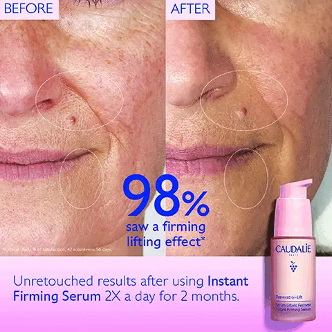 Before, After. 98% saw a firming lifting effect, clinical study % of satisfaction, 42 volunteers, 56 days. Unretouched results after using Instant Firming Serum 2x a day for 2 months. 98% saw a firming lifting effect, clinical study % of satisfaction, 42 volunteers, 56 days. 3x more effective than Retinol to firm & lift, ex vivo test on ingredients association on the thickness of collagen fibers at the serum concentration. Hyaluronic acids smooth & hydrate. Vegan collagen i, lifting effect. Resveratrol, anti-wrinkles. Collagen booster, firm skin. Which serum for your skin? Global Anti-aging. Wrinkles & firmness, Dark Spot & Radiance. Step 1, Instant Firming Serum. Step 2, Chashmere Cream, Lightweight Cashmere Cream, Firming Night Cream. Step 3, Firming Eye Gel Cream. How to recycle Resveratrol-Lift Serum Refill. Infinitely recyclable aluminium refill. Recycle the refill in the recycling bin.