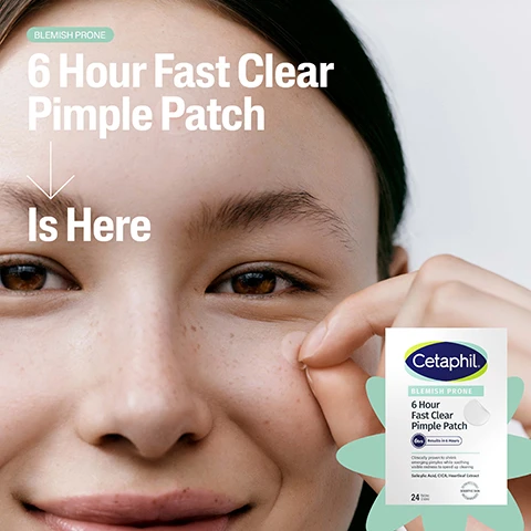Image 1 - A close-up of a young woman with a natural look, smiling and touching her cheek, alongside a product package for Cetaphils 6 Hour Fast Clear Pimple Patch, with text that reads BLEMISH PRONE 6 Hour Fast Clear Pimple Patch Is Here.
Image 2 - A box of Cetaphil Fast Clear Pimple Patch is shown, featuring text that reads Fights Emerging Pimples In Only 6 Hours and includes details about ingredients: Salicylic Acid, CICA, and Heartleaf, along with a total of 24 patches in the package.
Image 3 - A young man with dark skin is applying a pimple patch to his cheek, while the image highlights the text Clinically Proven To Target Emerging Pimples and displays a product box for Cetaphil 6 Hour Fast Clear Pimple Patch with the note Recommended by Dermatologists.
Image 4 - Image shows two close-up views of a persons skin with early-stage pimples, with the text Your Pre-Pimple Pimple Patch displayed above, and visible text stating Targets Early-Stage Spots and Not Intended For Whiteheads.
Image 5 - A person holds a Cetaphil 6 Hour Fast Clear Pimple Patch package with visible text stating Clinically Proven To Fight Emerging Pimples and In Only 6hrs.
Image 6 - A close-up of a person’s face showing a hand near their cheek with visible blue eyes, alongside graphics indicating ingredients for a blemish treatment, including Salicylic Acid, CICA, and Heartleaf, with a product image of Cetaphils 6 Hour Fast Clear Pimple Patch that reads Cetaphil 6 Hour Fast Clear Pimple Patch.
Image 7 - An assortment of items is displayed on a flat surface, including sunglasses, a pen, a silver tube, and a box of Cetaphil Blemish Prone 6 Hour Fast Clear Pimple Patch, with the words Target Emerging Pimples On-The-Go.
Image 8 - A persons hand reaching into the back pocket of jeans to retrieve a box of Cetaphil clear pimple patches, with the text On-The-Go Results. In Only 6 hrs. visible on the image.
Image 9 - A woman with a natural look is applying a pimple patch on her cheek while smiling gently; the image also features a box of Cetaphil 6 Hour Fast Clear Pimple Patch next to her, with visible text reading Fast Rescue Pimple Patch and Blemish Prone.