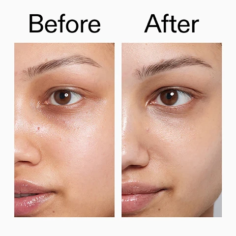 Image 1 - A split image shows the right side of a persons face with a visible dark under-eye area on the left side labeled Before, and the same face with a brighter, less discolored under-eye area on the right side labeled After. Image 2 - A person with freckles applies white cream under their eye, next to text that reads: Clinically proven to boost hydration by 160% after 1 hour*. Helps maintain skin moisture barrier throughout the day. Visibly reduce under-eye puffiness and brighten. *Clinical of 31 people. Image 3 - A close-up of a smiling persons face with radiant, hydrated skin and text that reads Why we love Ectoin Hydro-Barrier Serum. Hydrates and strengthens the skin barrier. Lightweight and non-sticky. Helps add bounce and firm skin. Image 4 - A close-up of a person applying eye cream under their left eye with their fingers while holding a white tube of product labeled CAFFEINE EYE CREAM Helps reduce the appearance of tired eyes Aide à réduire l’apparence des yeux fatigués. Image 5 - Close-up of a person with dark skin and a radiant glow, looking up as their hand gently touches their cheek, with the text Why we love Hydro-Surge Dewy Face Mist Instant hydration and glow on the go. Use on bare skin or over makeup. Spritz any time, anywhere. Image 6 - An image with a white background textured with water droplets displays a step-by-step guide titled How to layer Daily Hydration & Brightening Trio, with step 1 Ectoin Hydro-Barrier Serum AFTER CLEANSING, APPLY A PEA-SIZED AMOUNT TO CLEAN, DRY SKIN., step 2 Hydro-Surge Dewy Face Mist SPRITZ 2-3 TIMES OVER FACE AND NECK AFTER SKINCARE OR THROUGHOUT THE DAY., and step 3 Caffeine Eye Cream GENTLY PAT A SMALL AMOUNT UNDER THE EYES USING YOUR RING FINGER. Image 7 - Three The Inkey List skincare products are displayed on a white background: a tall black and white Ectoin Hydro-Barrier Serum pump bottle, a clear Hydro-Surge Dewy Face Mist spray bottle, and a white Caffeine Eye Cream tube, with a red and white CEW Beauty Award Winner 2025 badge shown above the serum bottle, featuring the text CEW Beauty Award Winner 2025, THE INKEY LIST ECTOIN HYDRO-BARRIER SERUM 1.0 US fl. oz / 30ml, THE INKEY LIST HYDRO-SURGE DEWY FACE MIST 2.5 US fl. oz / 75ml, THE INKEY LIST CAFFEINE EYE CREAM 0.5 US fl. oz / 15ml.