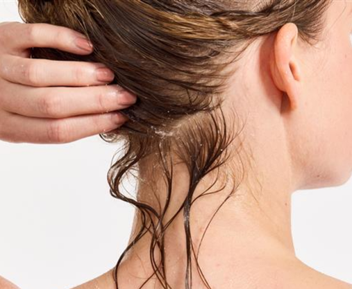 Ameliorate for Itchy Scalp