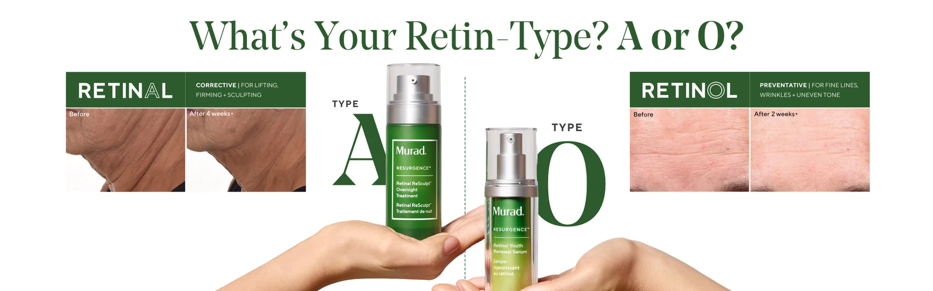 Murad brand room top banner - retin type - A or O.